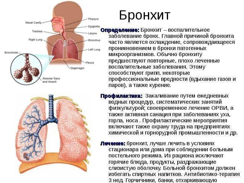 Бронхит - симптомы заболевания, диагностика и способы лечения