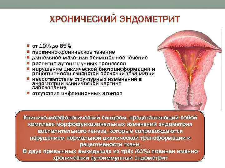 Нужно ли лечить эндометриоз? какие симптомы и способы лечения болезни?