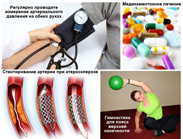 Разное артериальное давление на руках: причина и лечение, какое правильное