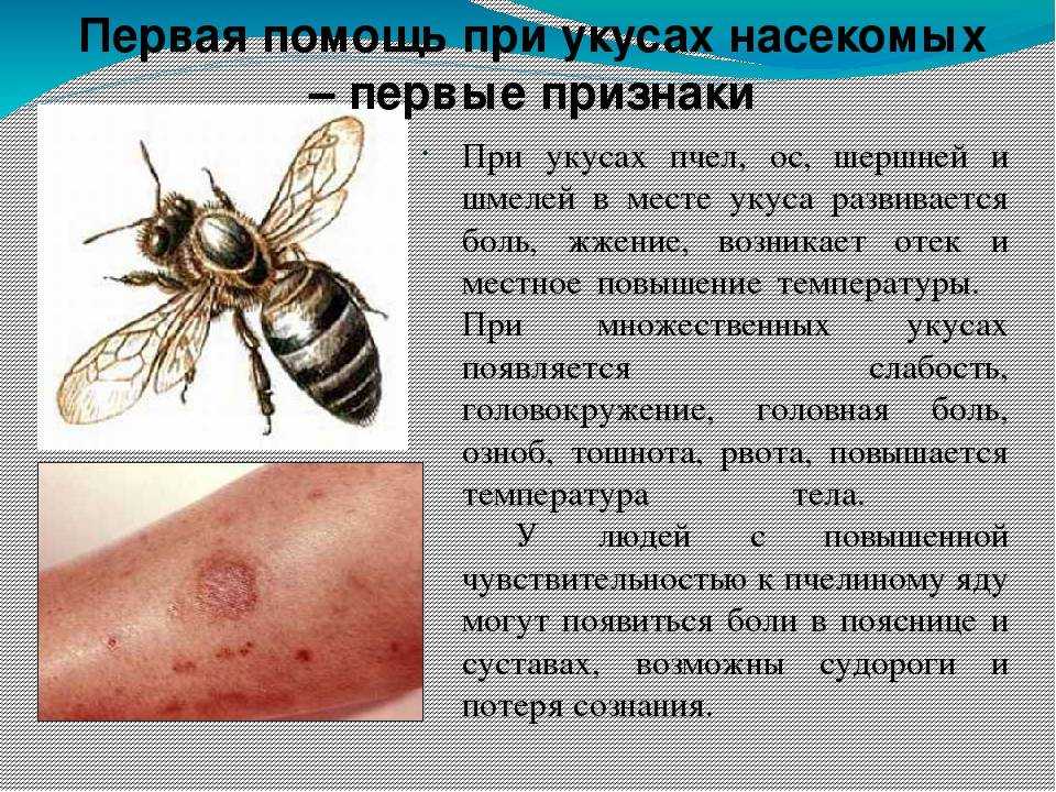 Правила оказания первой помощи при укусе пчелы или осы, фото | rvdku.ru