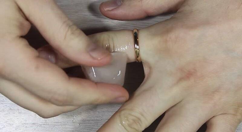 Как снять кольцо с опухшего пальца