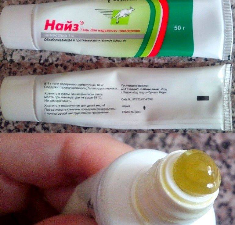 Что лучше гель или мазь?