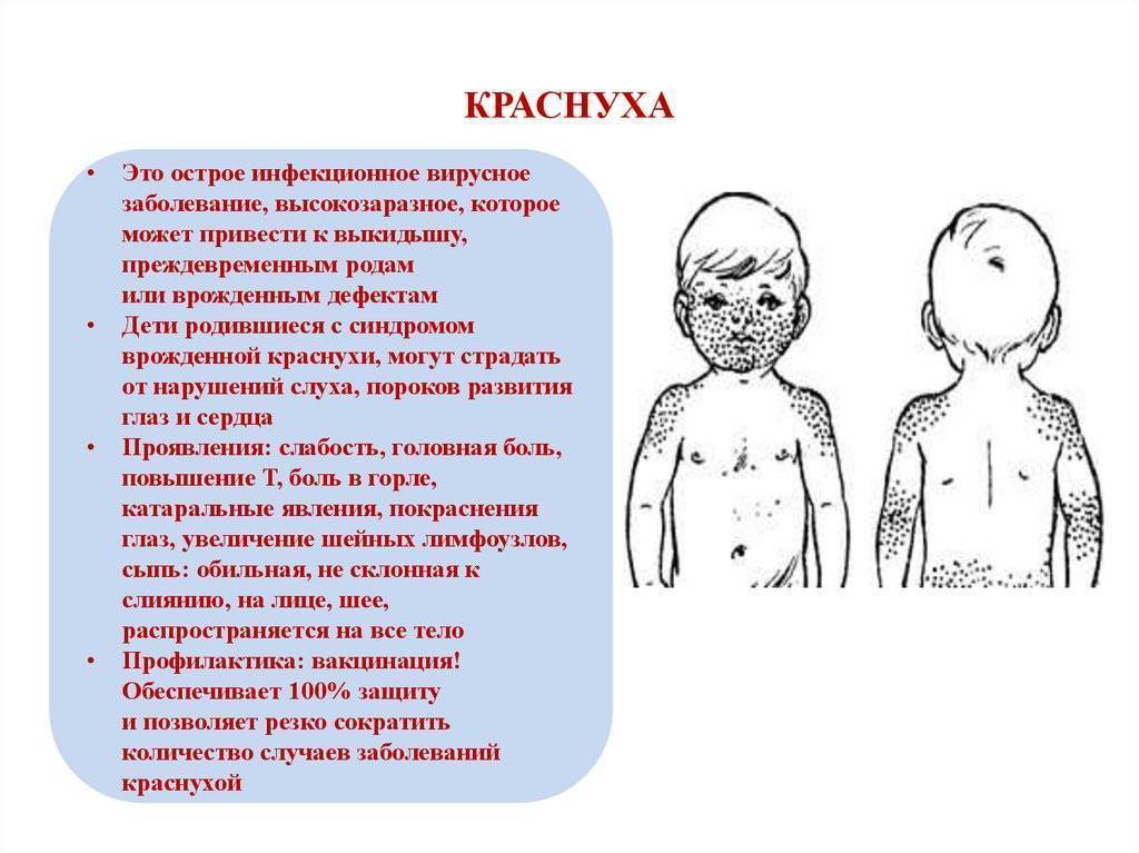 Чем отличается ветрянка от краснухи и кори? ветрянка и краснуха – это одно и то же заболевание? отличия.