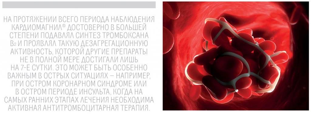 Что выбрать: кардиомагнил или аспирин кардио?