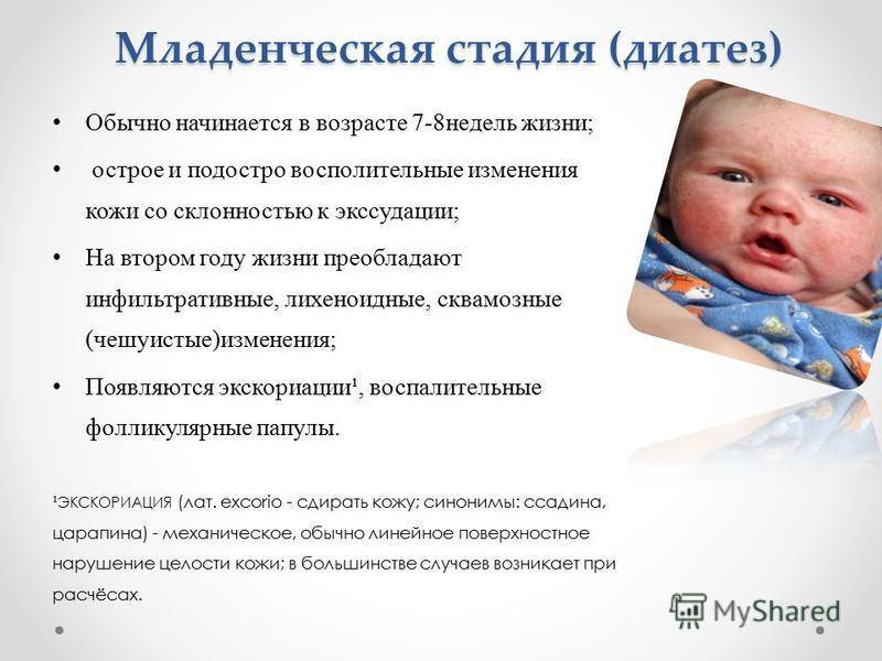 Аллергический диатез – уход за кожей